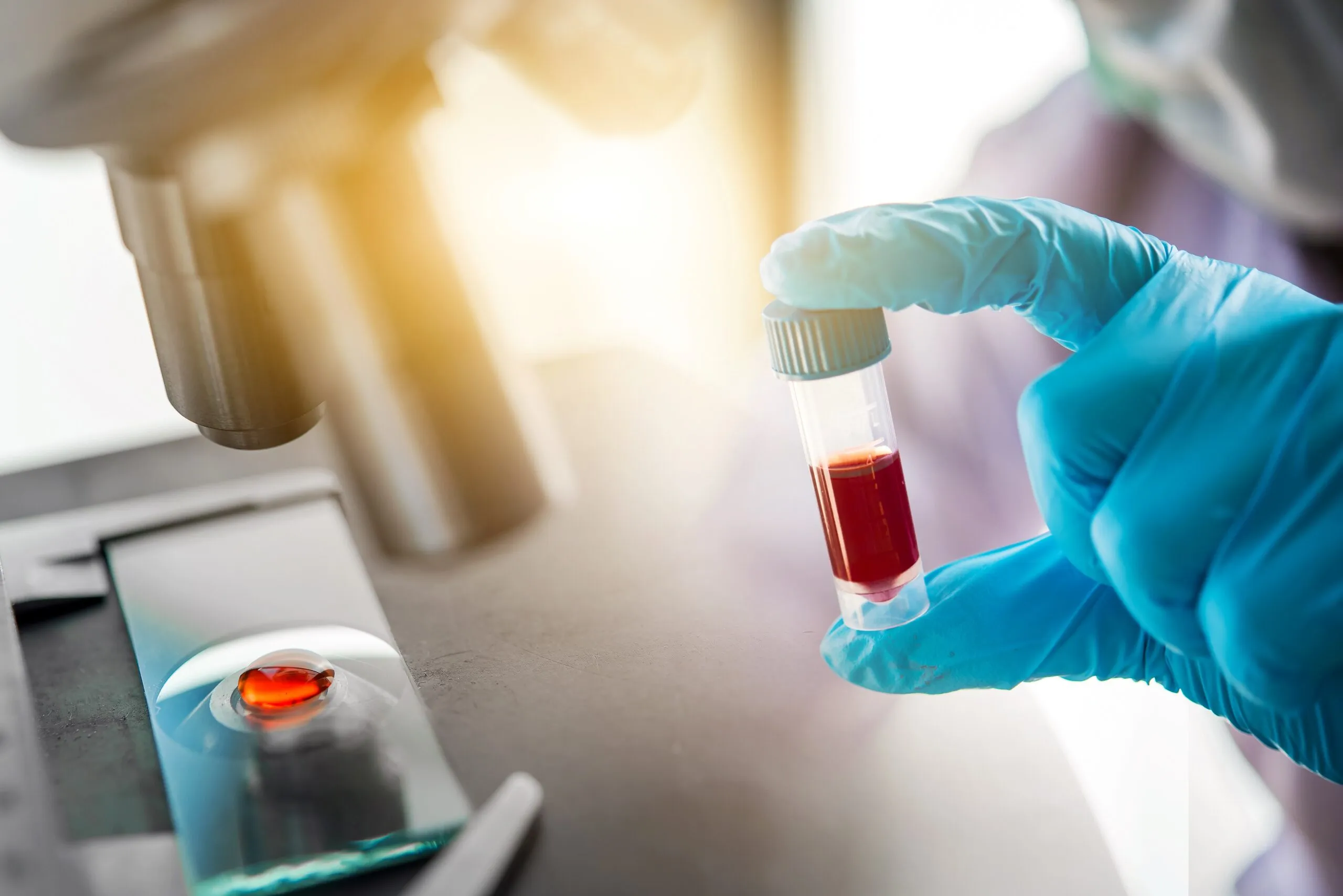 Moderne Blutanalyse im Labor: Mikroskopische Auswertung einer Blutprobe zur individuellen Gesundheitsdiagnostik