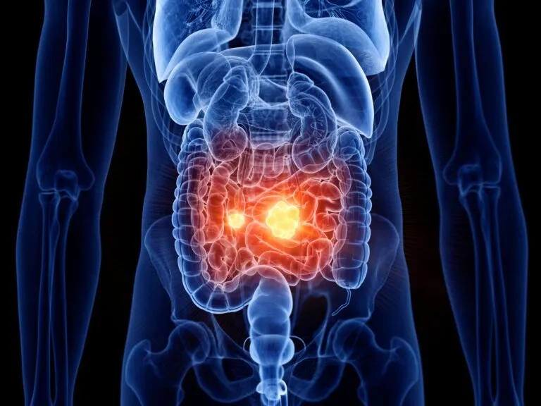 Leaky-Gut