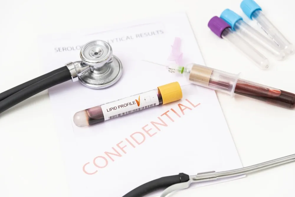 Blutprobenröhrchen mit der Aufschrift „Lipid Profile“ auf einem Dokument mit dem Vermerk „Confidential“, daneben ein Stethoskop, eine Spritze mit Blut und weitere leere Probenröhrchen.