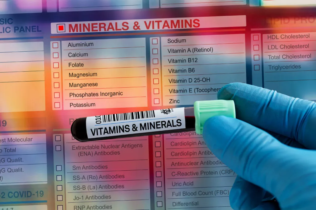Nahaufnahme eines Blutprobenröhrchens mit der Aufschrift „Vitamins & Minerals“, gehalten von einer Hand in blauen Handschuhen vor einer Laboranforderungsliste mit verschiedenen Mineralien- und Vitaminwerten wie Magnesium, Zink, Vitamin D und Vitamin B12.