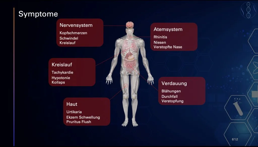 Grafik zu typischen Symptomen einer Histaminintoleranz: Nervensystem – Kopfschmerzen, Schwindel, Kreislaufprobleme; Atemsystem – Rhinitis, Niesen, verstopfte Nase; Kreislauf – Tachykardie, Hypotonie, Kollaps; Haut – Urtikaria, Ekzem, Schwellung, Juckreiz, Flush; Verdauung – Blähungen, Durchfall, Verstopfung. Anatomische Figur mit markierten betroffenen Bereichen.