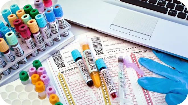 Laborzubehör mit Blutröhrchen, Formularen und Laptop – visuelle Darstellung einer Blutanalyse
